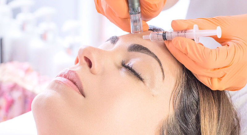 formation-microneedling-en-ligne.jpg